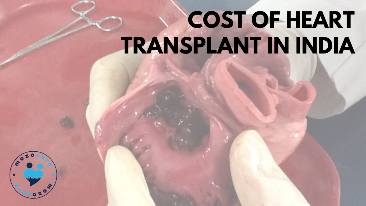 Cost of Heart Transplant In India