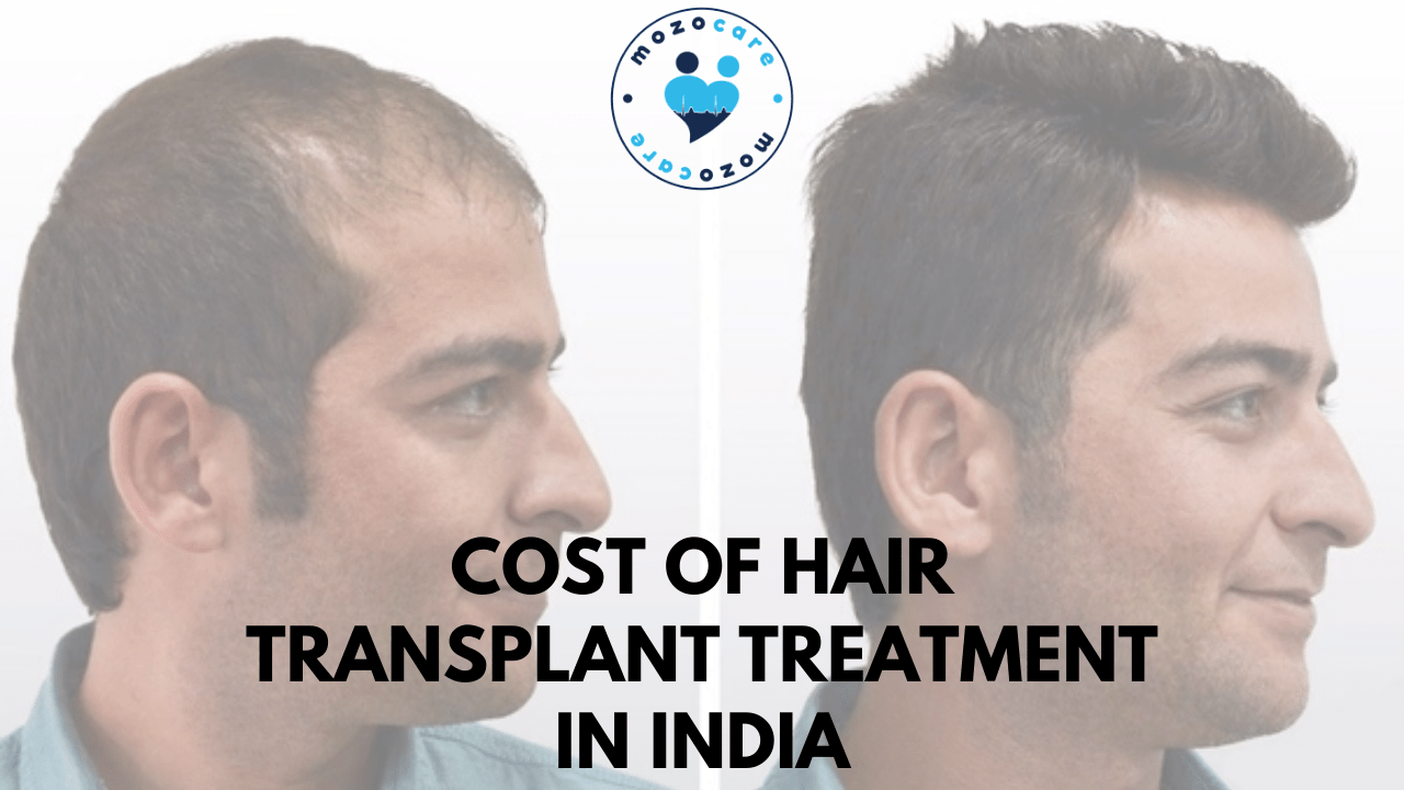 What is the Hair Transplant Cost in India? | Fue , Fut , Grafts | Mozocare