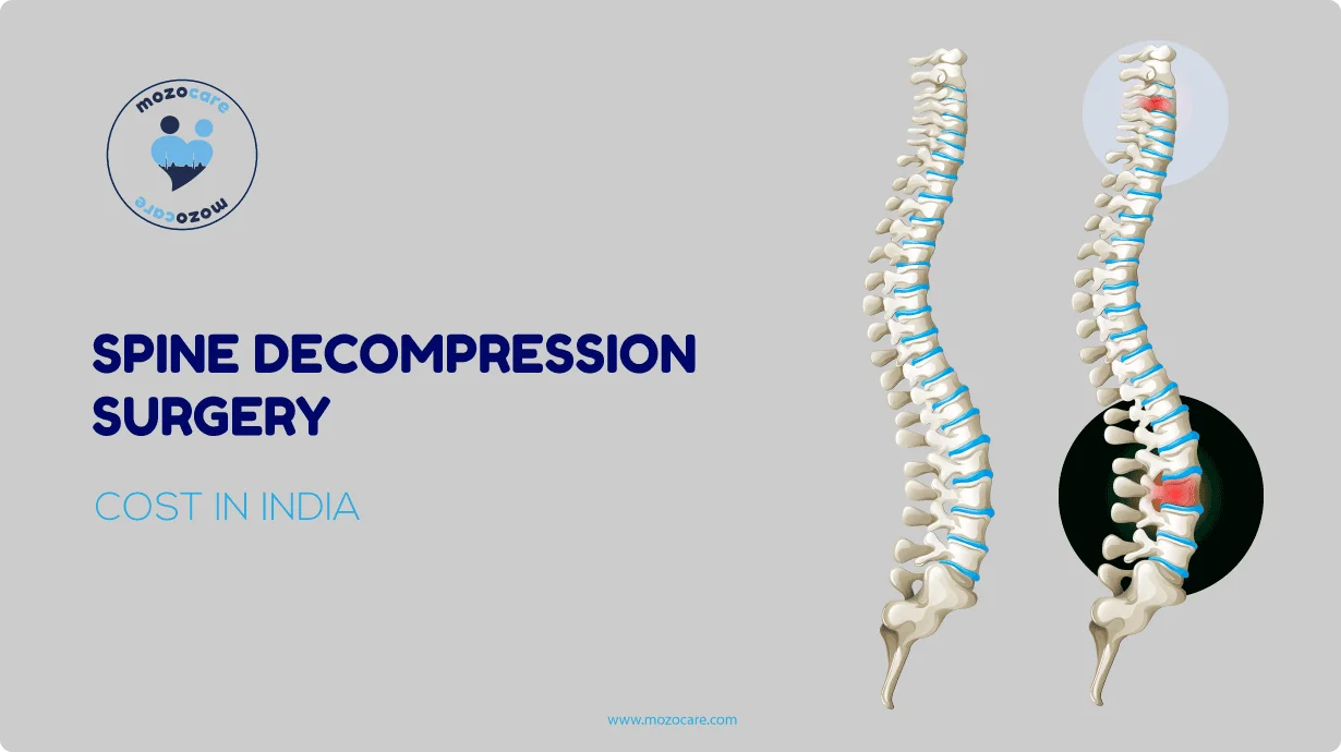 Cost of spine decompression in india