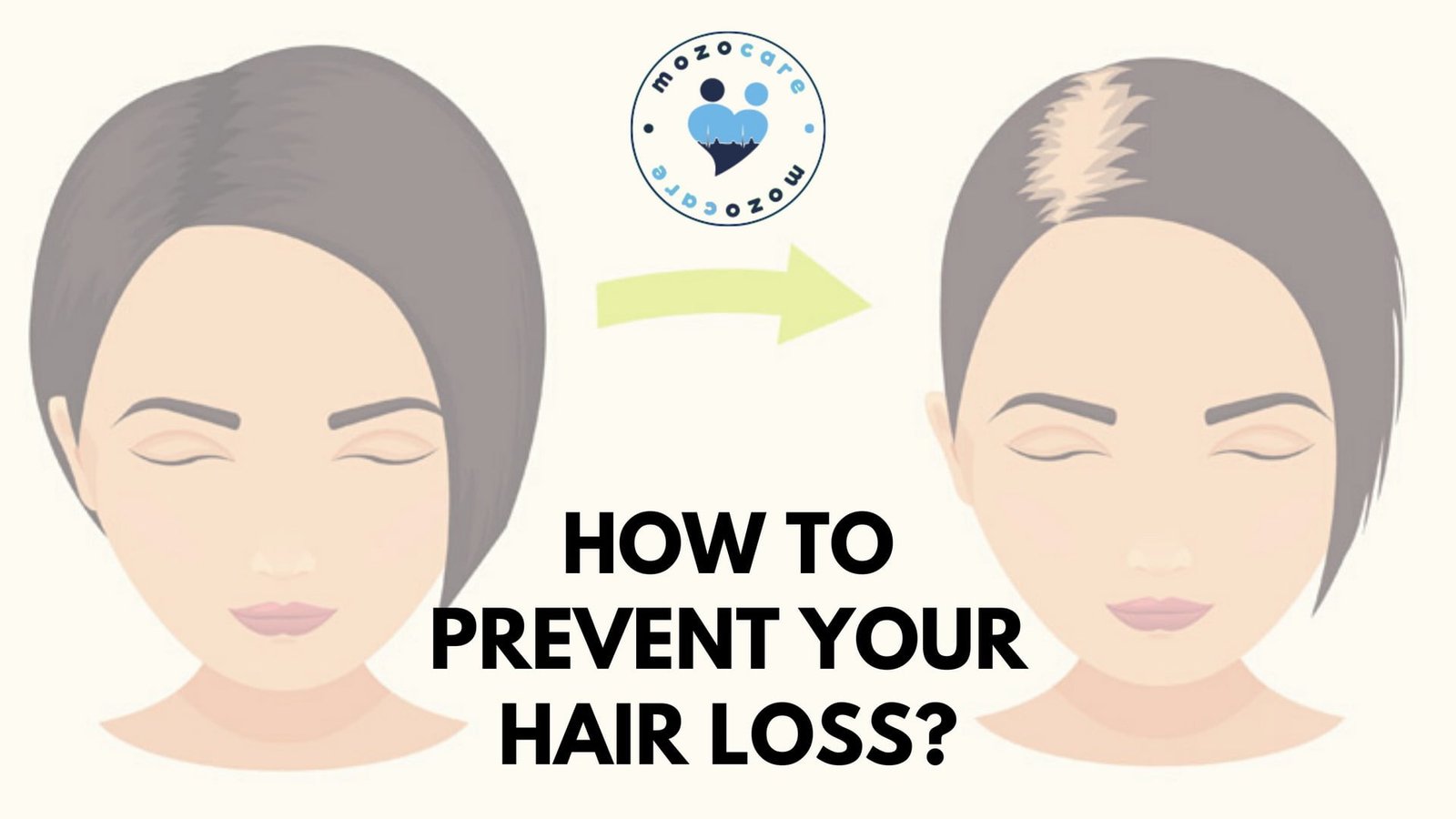 How To Prevent Your Hair Loss