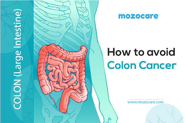How to avoid colon cancer