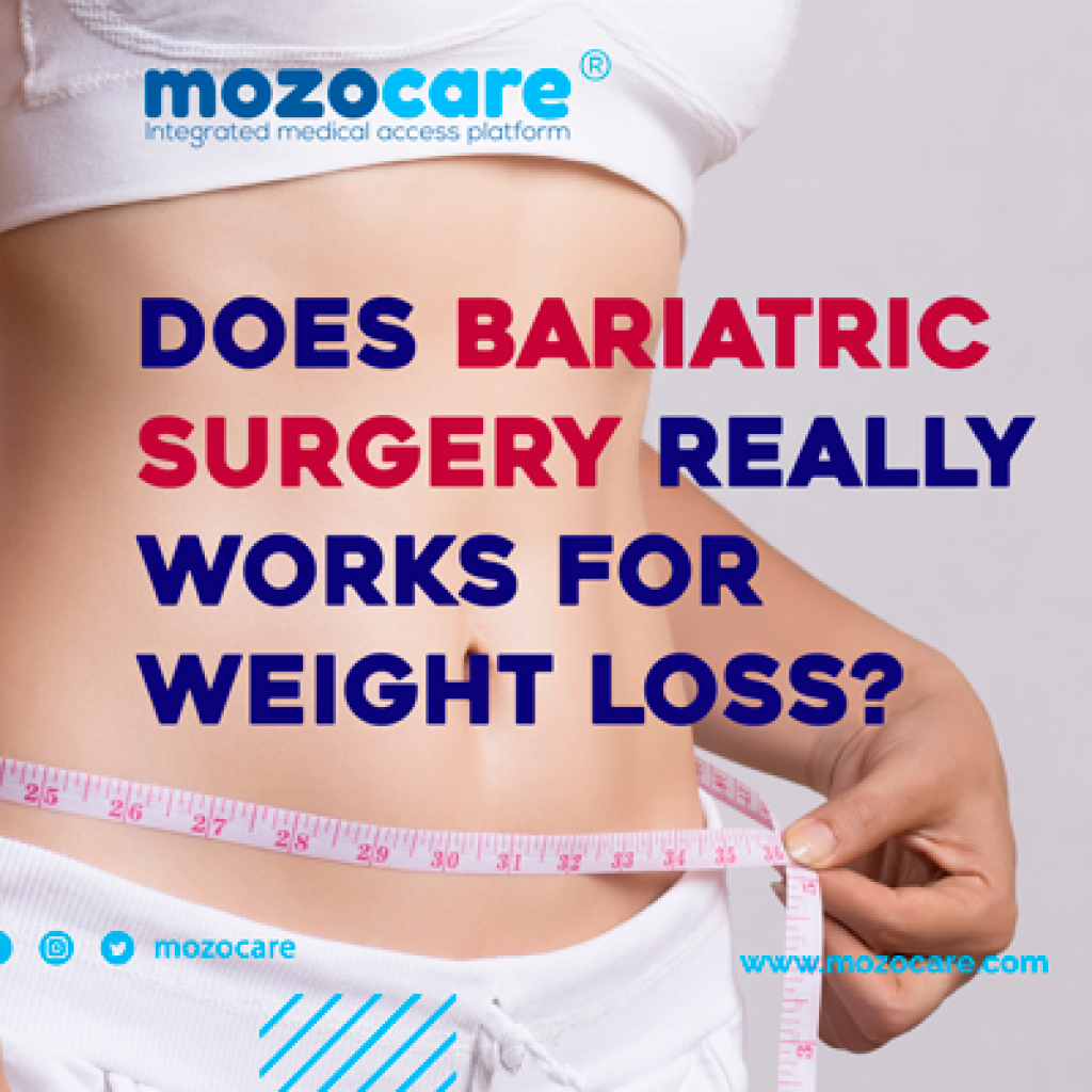 does-bariatric-surgery-really-works-for-weightloss