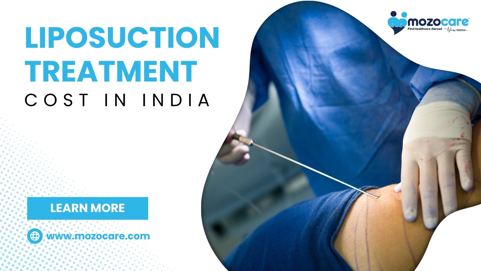 Liposuction Treatment Cost In India
