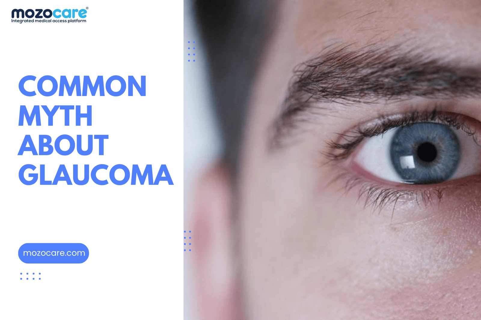 Common Myth About Glaucoma
