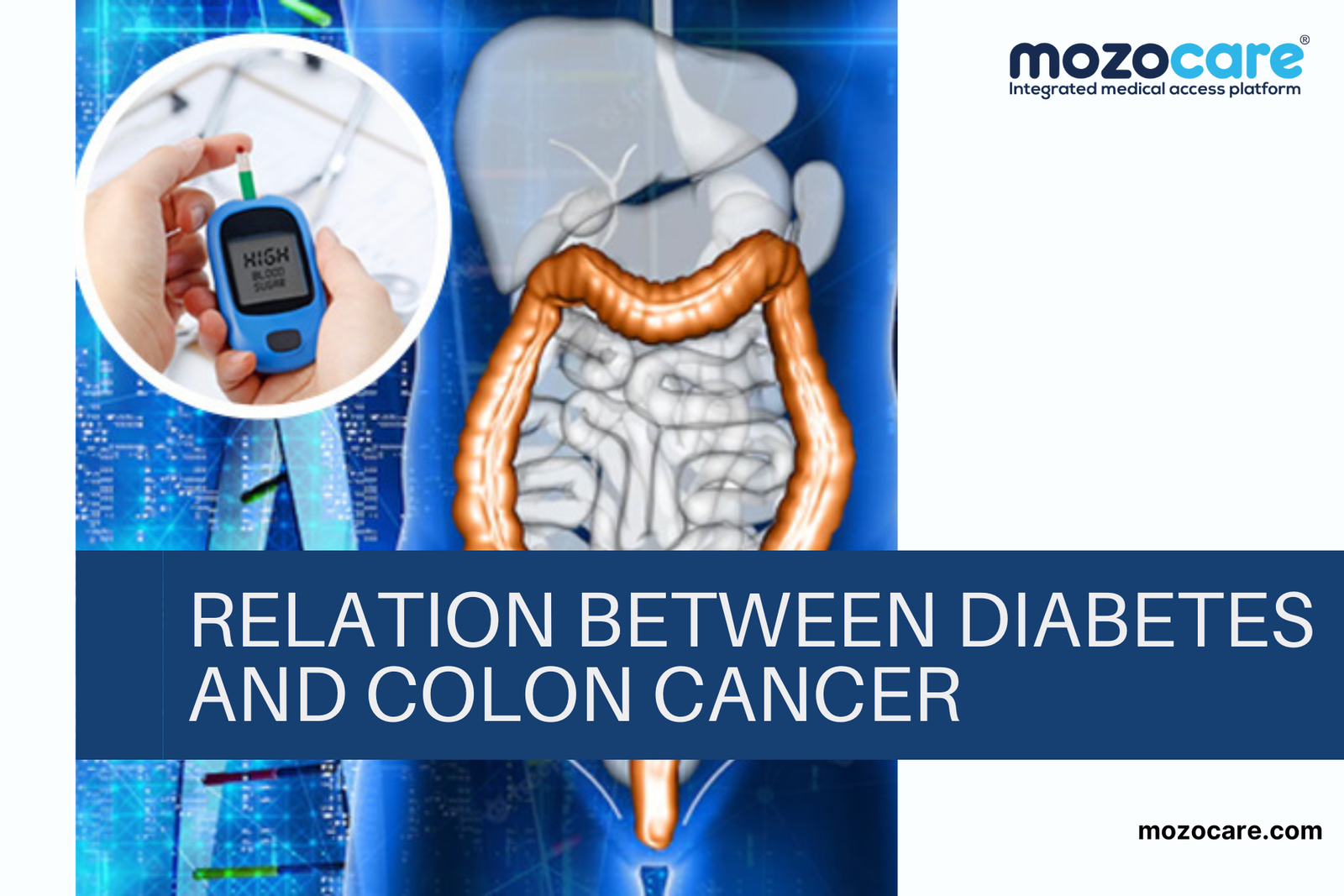 Relationship Between Diabetes and Colorectal Cancer