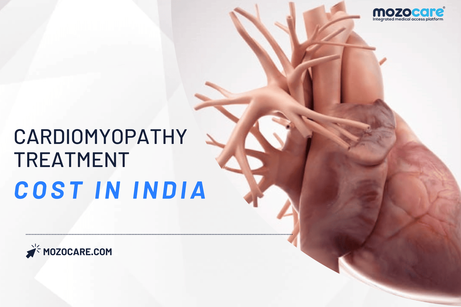 Cardiomyopathy Treatment Cost In India